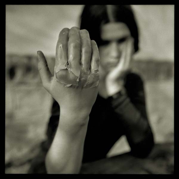 It doesn’t hurt, Újezd – Hájenka, Czech Republic, 2002